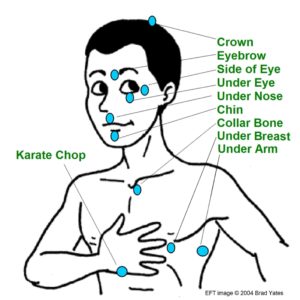 Photo of EFT Meridian points